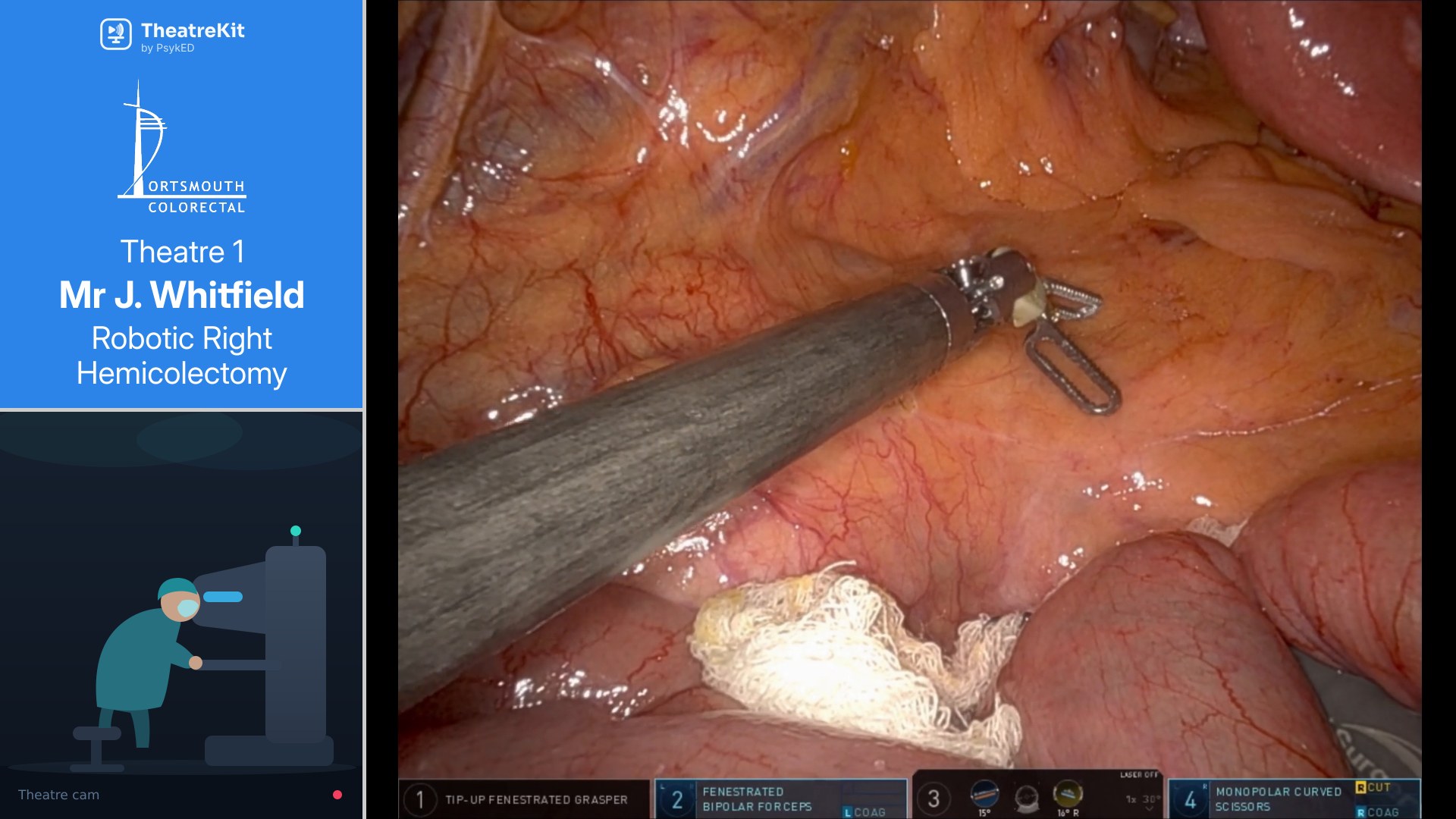 A TheatreKit recording: robotic instrument feed beside the theatre camera and a case details panel reading Theatre 1, Mr J. Whitfield, Robotic Right Hemicolectomy